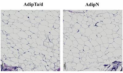 Adipose Tissue Properties in Tumor-Bearing Breasts